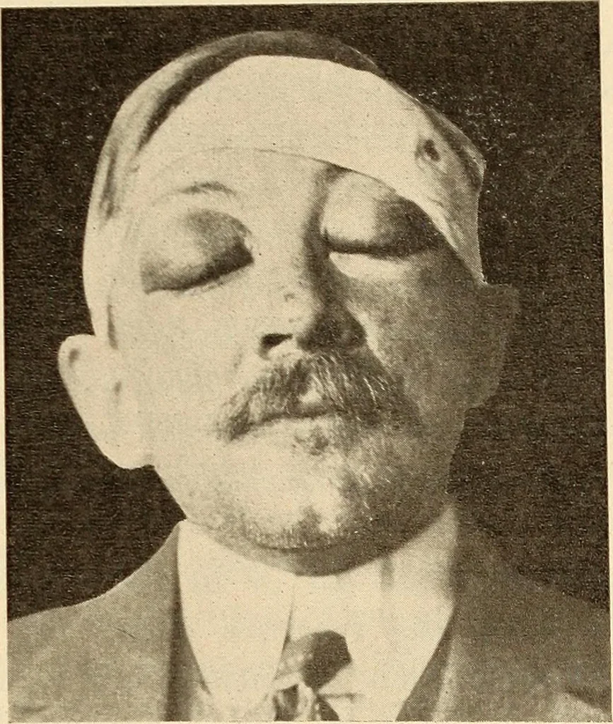 An illustration from Fractures and dislocations, diagnosis and treatment, 1915, leaf 450
