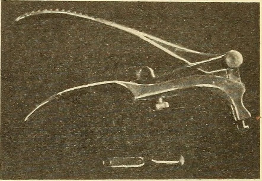 An illustration from Fractures and dislocations, diagnosis and treatment, 1915, leaf 479