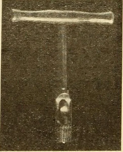 An illustration from Fractures and dislocations, diagnosis and treatment, 1915, leaf 479
