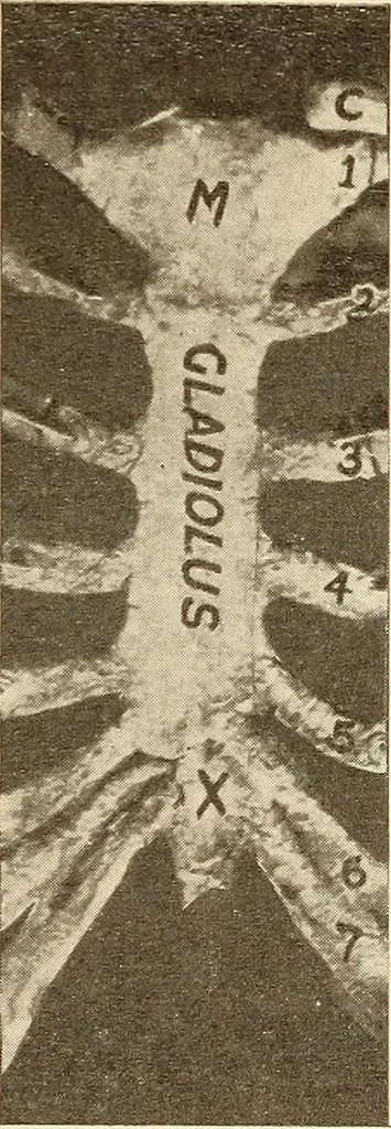 An illustration from Fractures and dislocations, diagnosis and treatment, 1915, leaf 484