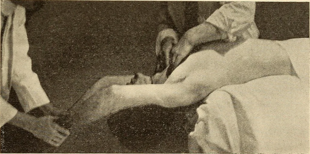 An illustration from Fractures and dislocations, diagnosis and treatment, 1915, leaf 488