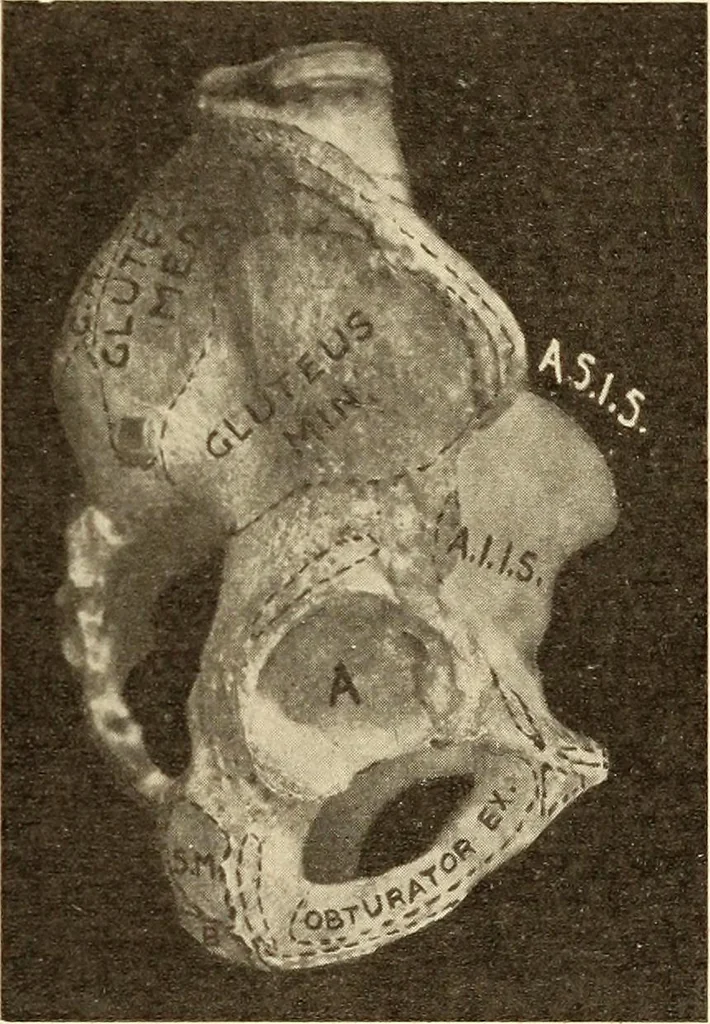 An illustration from Fractures and dislocations, diagnosis and treatment, 1915, leaf 524