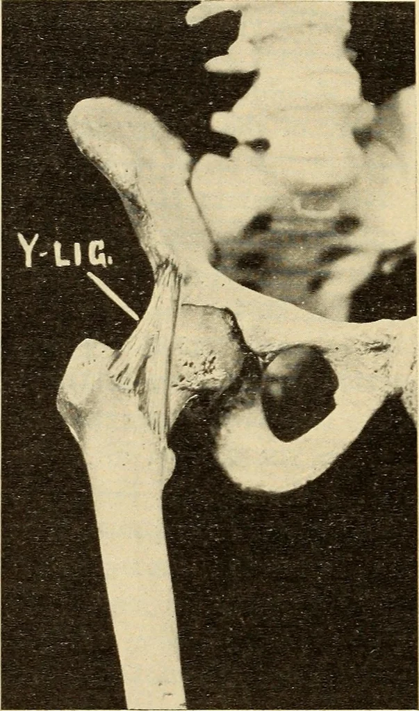 An illustration from Fractures and dislocations, diagnosis and treatment, 1915, leaf 547