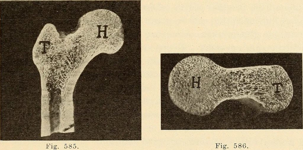 An illustration from Fractures and dislocations, diagnosis and treatment, 1915, leaf 562