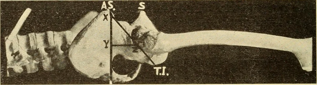 An illustration from Fractures and dislocations, diagnosis and treatment, 1915, leaf 565