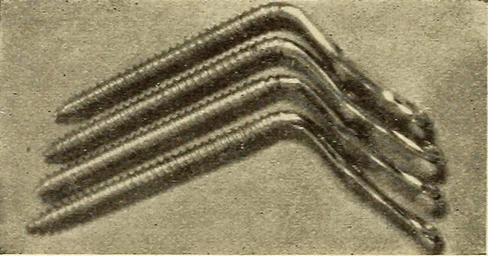 An illustration from Fractures and dislocations, diagnosis and treatment, 1915, leaf 581