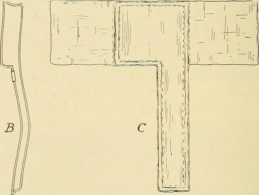 An illustration from Fractures and dislocations, diagnosis and treatment, 1915, leaf 611