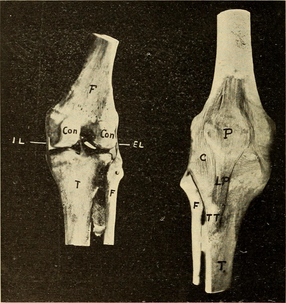 An illustration from Fractures and dislocations, diagnosis and treatment, 1915, leaf 645