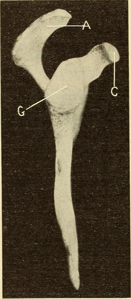 An illustration from Fractures and dislocations, diagnosis and treatment, 1915, leaf 69