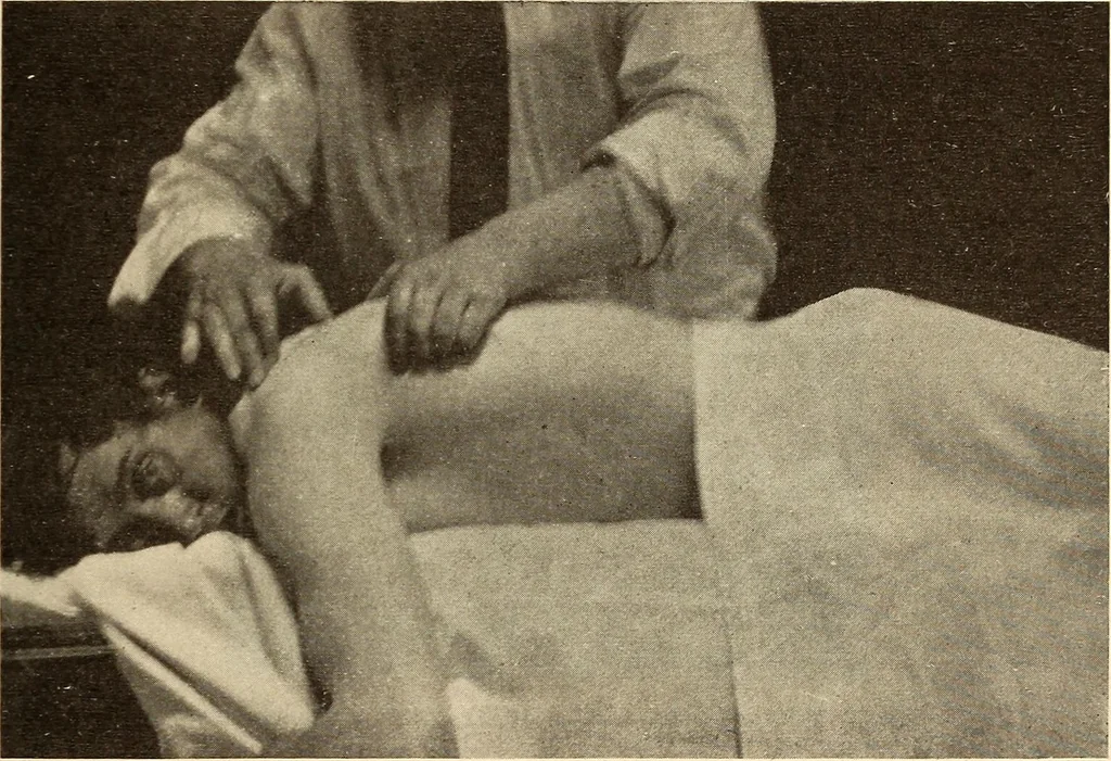 An illustration from Fractures and dislocations, diagnosis and treatment, 1915, leaf 72