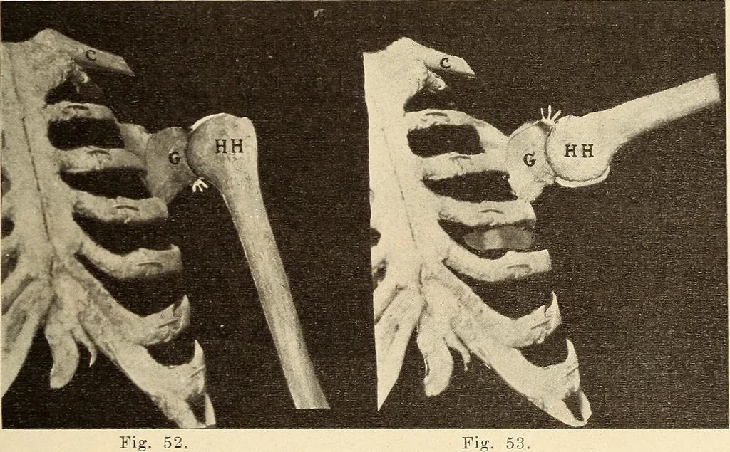 An illustration from Fractures and dislocations, diagnosis and treatment, 1915, leaf 76