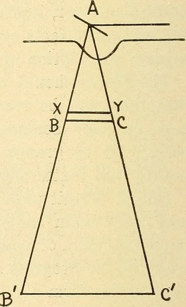 An illustration from Fractures and dislocations, diagnosis and treatment, 1915, leaf 771