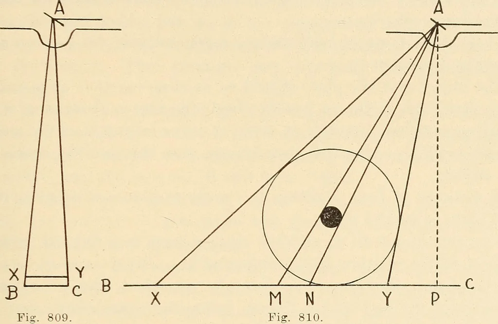 An illustration from Fractures and dislocations, diagnosis and treatment, 1915, leaf 772