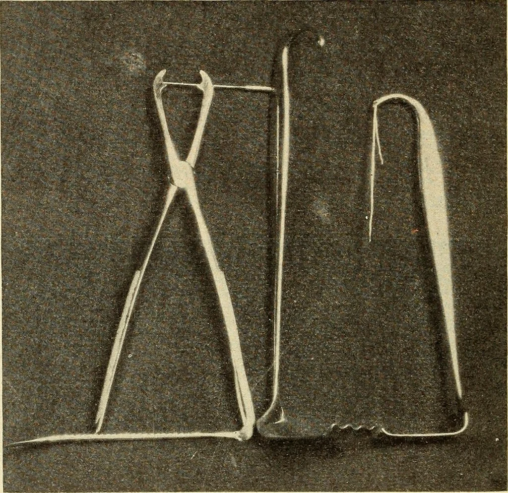 An illustration from Fractures and dislocations, diagnosis and treatment, 1915, leaf 789
