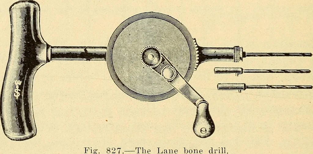 An illustration from Fractures and dislocations, diagnosis and treatment, 1915, leaf 789