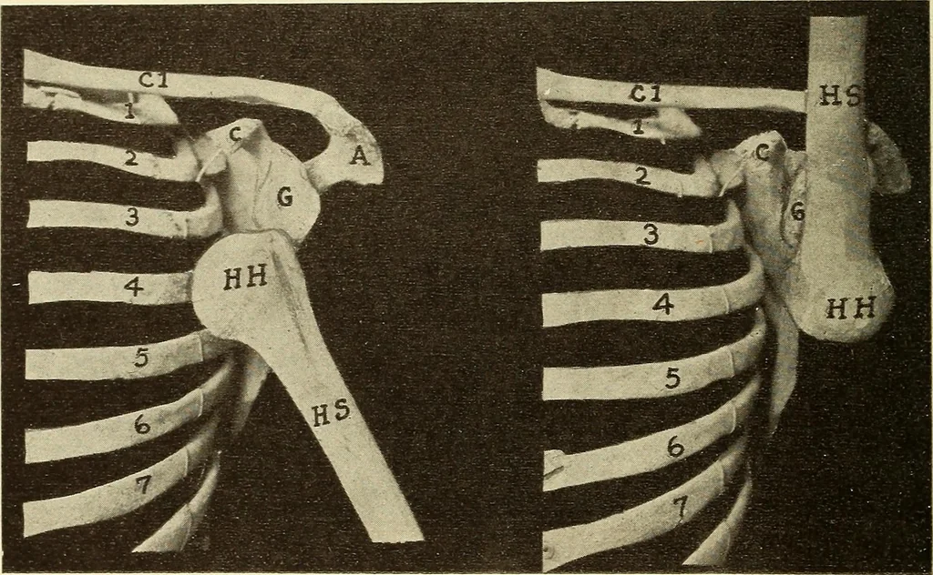 An illustration from Fractures and dislocations, diagnosis and treatment, 1915, leaf 79