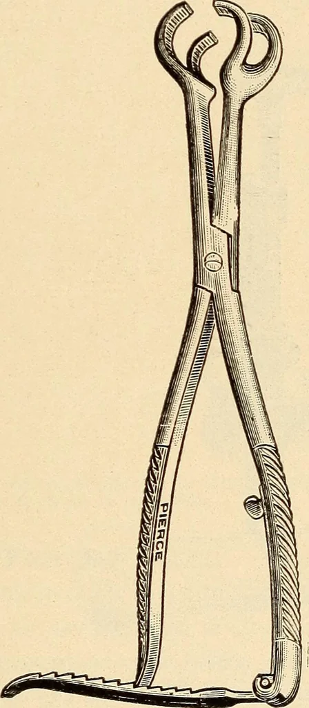 An illustration from Fractures and dislocations, diagnosis and treatment, 1915, leaf 790