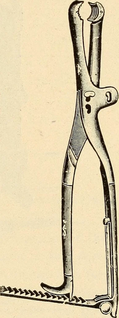 An illustration from Fractures and dislocations, diagnosis and treatment, 1915, leaf 790