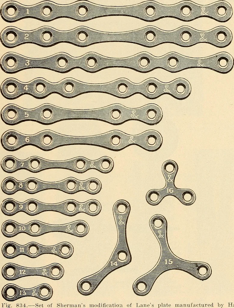 An illustration from Fractures and dislocations, diagnosis and treatment, 1915, leaf 794