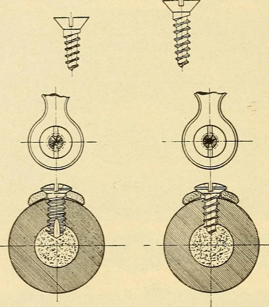 An illustration from Fractures and dislocations, diagnosis and treatment, 1915, leaf 795