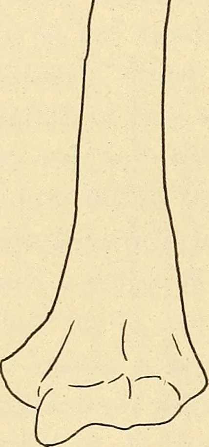 An illustration from Fractures and dislocations, diagnosis and treatment, 1915, leaf 815