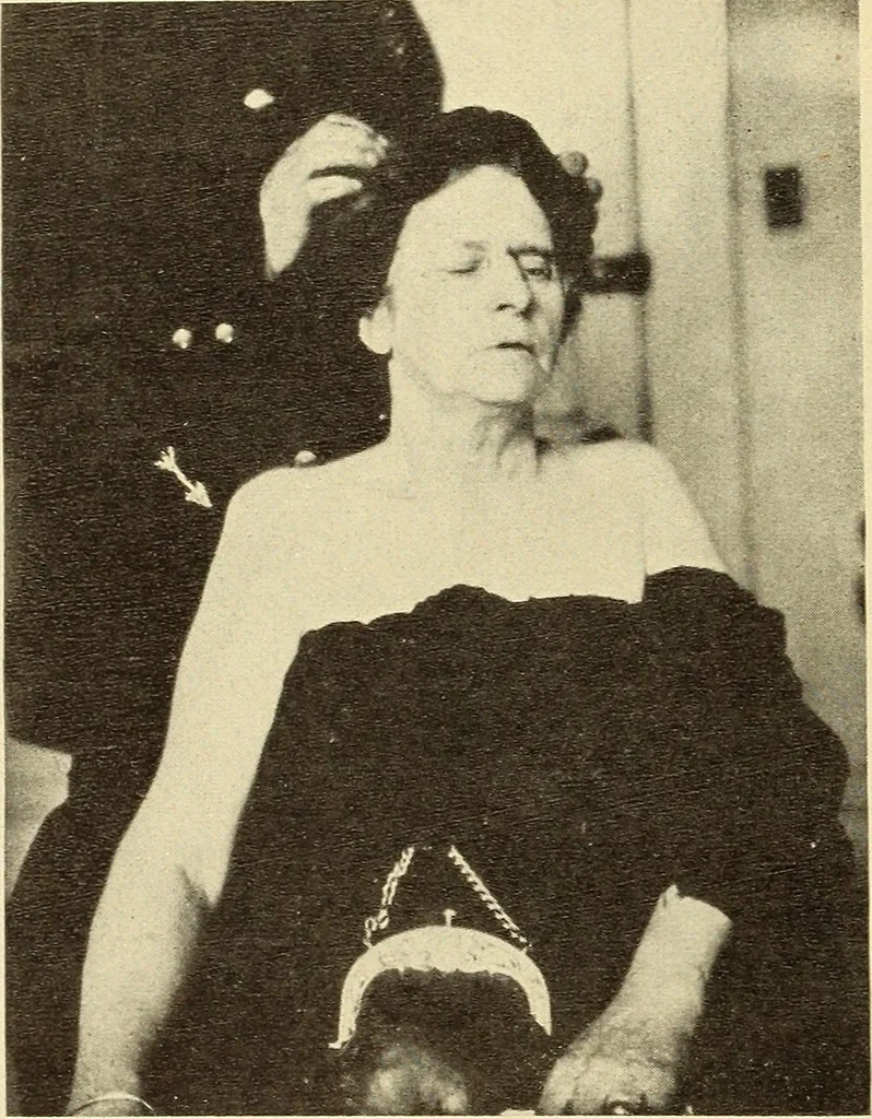 An illustration from Fractures and dislocations, diagnosis and treatment, 1915, leaf 95