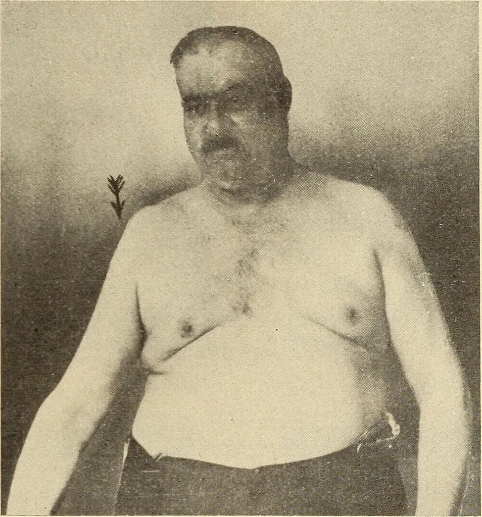 An illustration from Fractures and dislocations, diagnosis and treatment, 1915, leaf 96