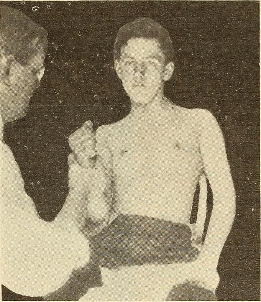 An illustration from Fractures and dislocations, diagnosis and treatment, 1915, leaf 98