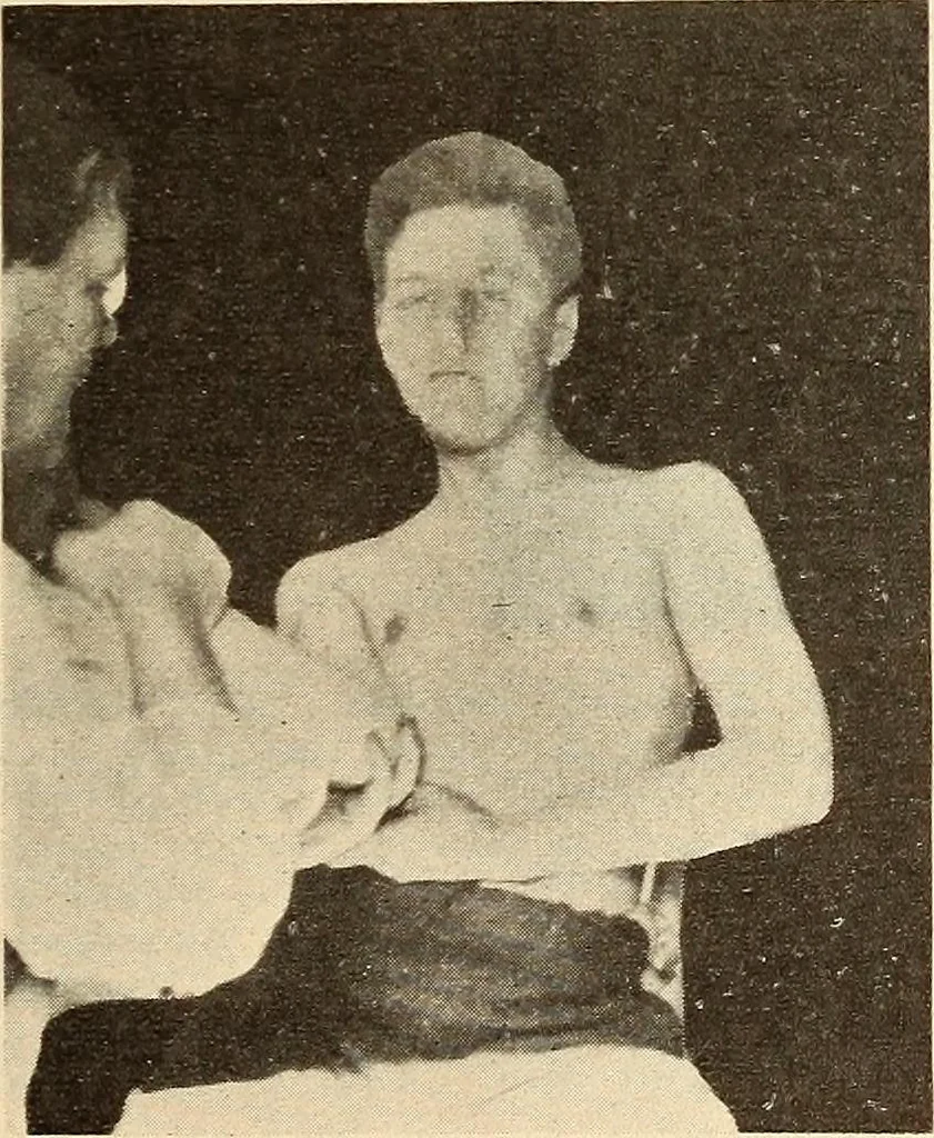 An illustration from Fractures and dislocations, diagnosis and treatment, 1915, leaf 98