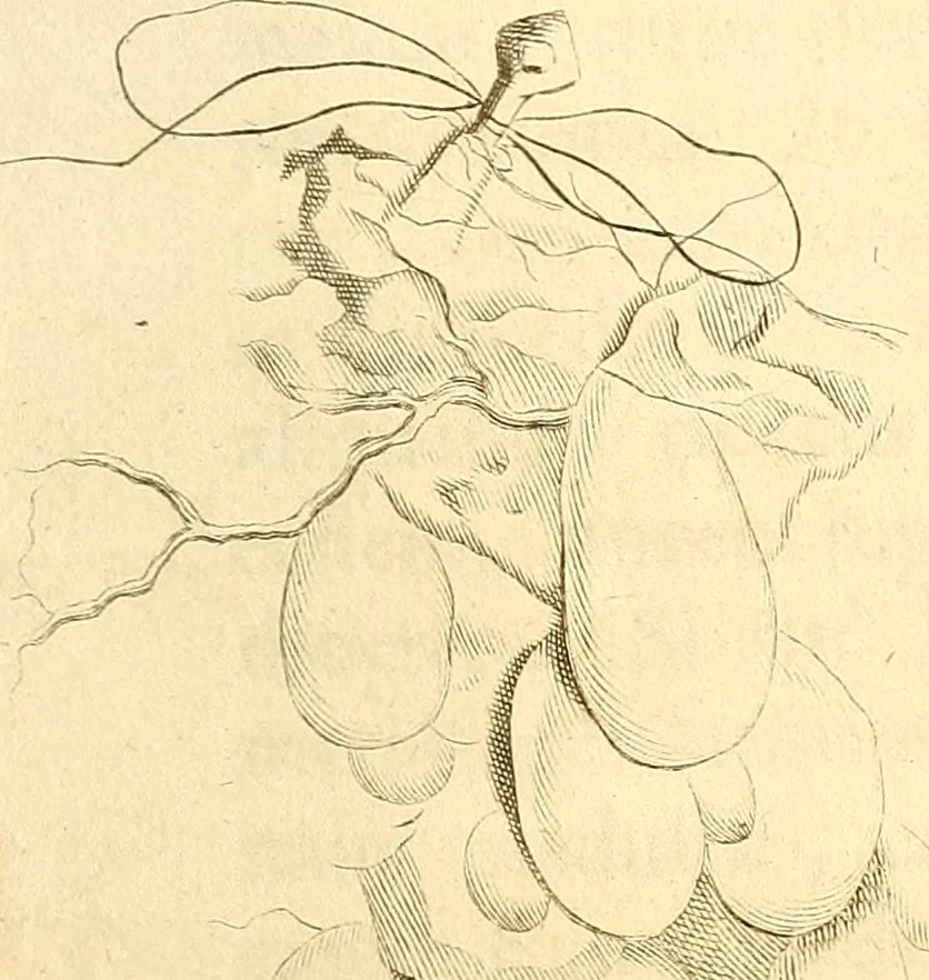 An illustration from Frederici Ruyschii ... Observationum anatomico-chirurgicarum centuria : accedit catalogus rariorum, quae in museo Ruyschiano asservantur ..., 1691, leaf 100