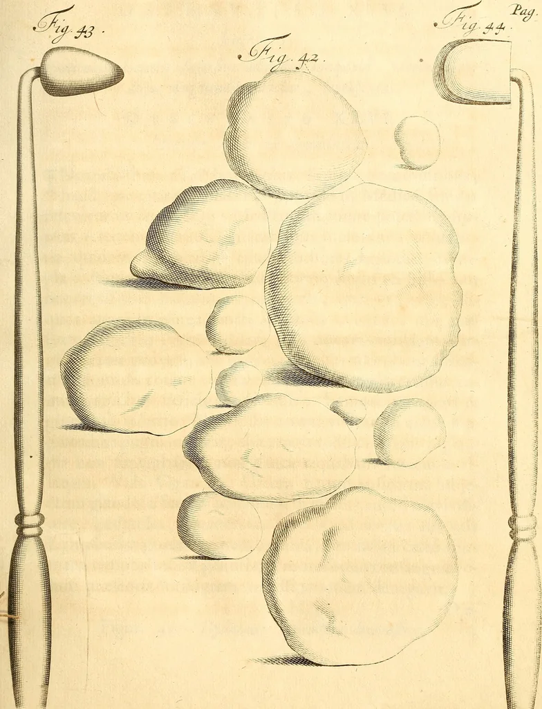 An illustration from Frederici Ruyschii ... Observationum anatomico-chirurgicarum centuria : accedit catalogus rariorum, quae in museo Ruyschiano asservantur ..., 1691, leaf 124