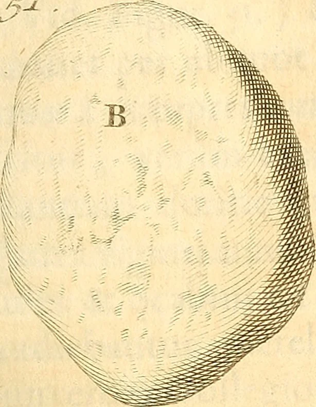 An illustration from Frederici Ruyschii ... Observationum anatomico-chirurgicarum centuria : accedit catalogus rariorum, quae in museo Ruyschiano asservantur ..., 1691, leaf 144