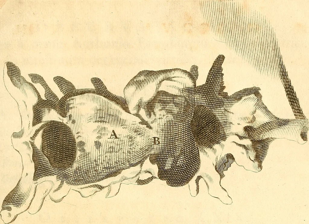 An illustration from Frederici Ruyschii ... Observationum anatomico-chirurgicarum centuria : accedit catalogus rariorum, quae in museo Ruyschiano asservantur ..., 1691, leaf 164