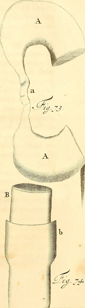 An illustration from Frederici Ruyschii ... Observationum anatomico-chirurgicarum centuria : accedit catalogus rariorum, quae in museo Ruyschiano asservantur ..., 1691, leaf 212