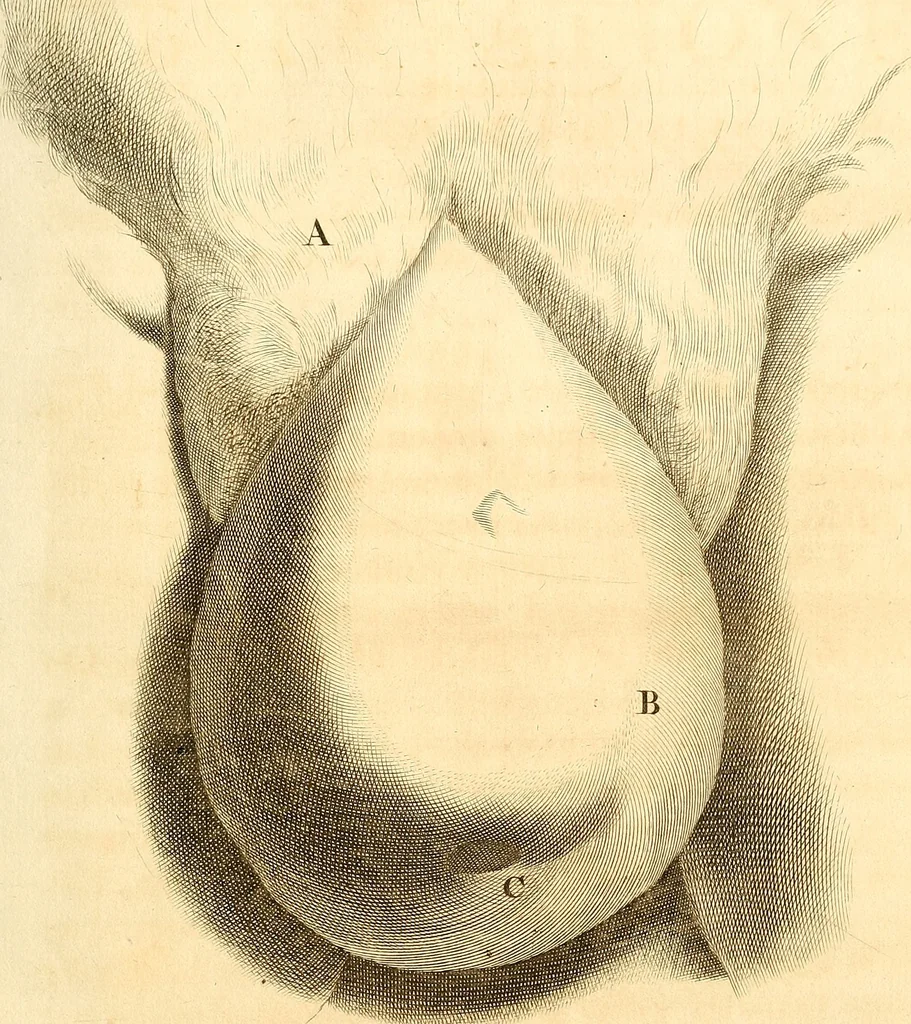 An illustration from Frederici Ruyschii ... Observationum anatomico-chirurgicarum centuria : accedit catalogus rariorum, quae in museo Ruyschiano asservantur ..., 1691, leaf 22