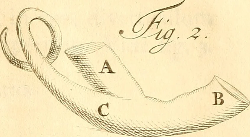 An illustration from Frederici Ruyschii ... Observationum anatomico-chirurgicarum centuria : accedit catalogus rariorum, quae in museo Ruyschiano asservantur ..., 1691, leaf 308