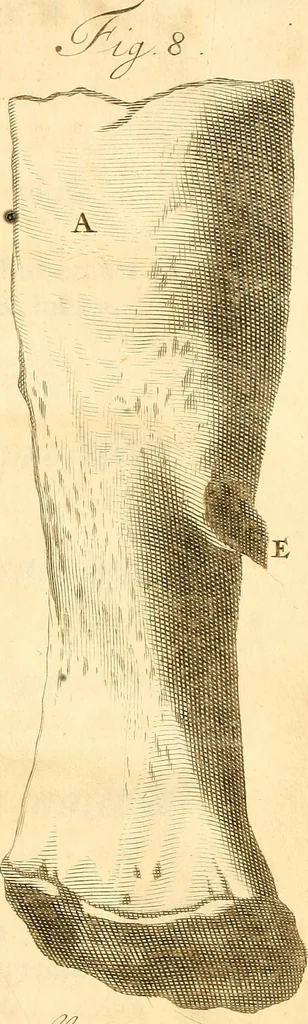 An illustration from Frederici Ruyschii ... Observationum anatomico-chirurgicarum centuria : accedit catalogus rariorum, quae in museo Ruyschiano asservantur ..., 1691, leaf 344