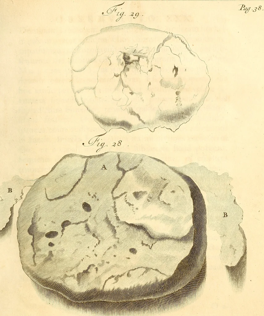 An illustration from Frederici Ruyschii ... Observationum anatomico-chirurgicarum centuria : accedit catalogus rariorum, quae in museo Ruyschiano asservantur ..., 1691, leaf 86