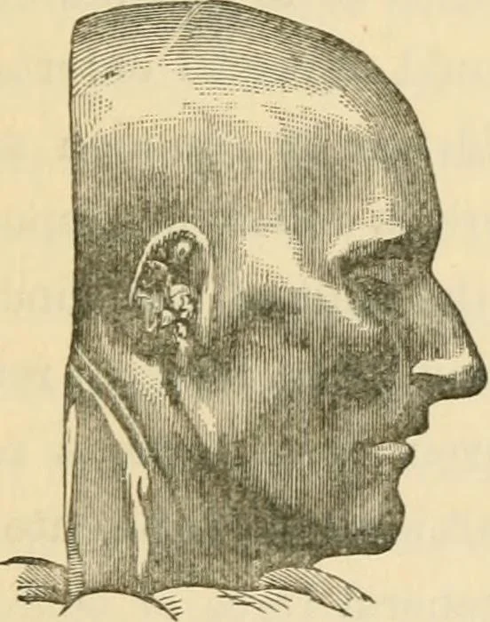 An illustration from The fundamental principles of phrenology are the only principles capable of being reconciled with the immateriality and immortality of the soul, 1868, leaf 475
