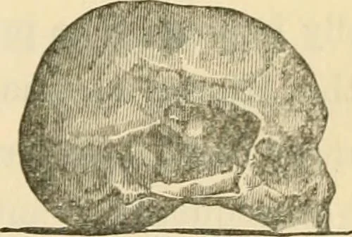 An illustration from The fundamental principles of phrenology are the only principles capable of being reconciled with the immateriality and immortality of the soul, 1868, leaf 475