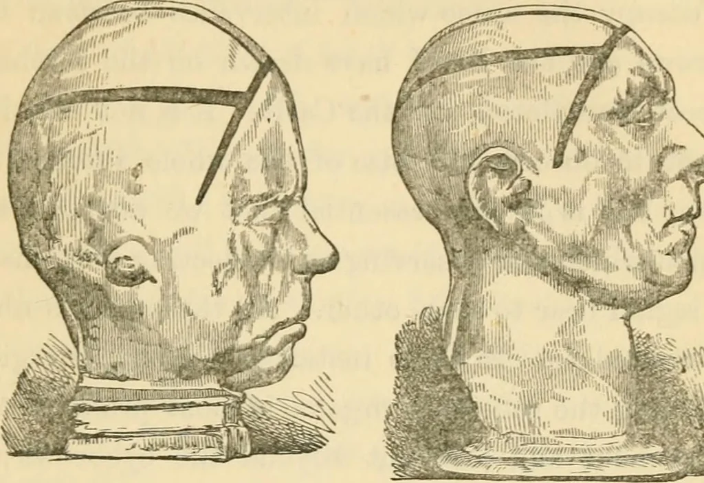 An illustration from The fundamental principles of phrenology are the only principles capable of being reconciled with the immateriality and immortality of the soul, 1868, leaf 479