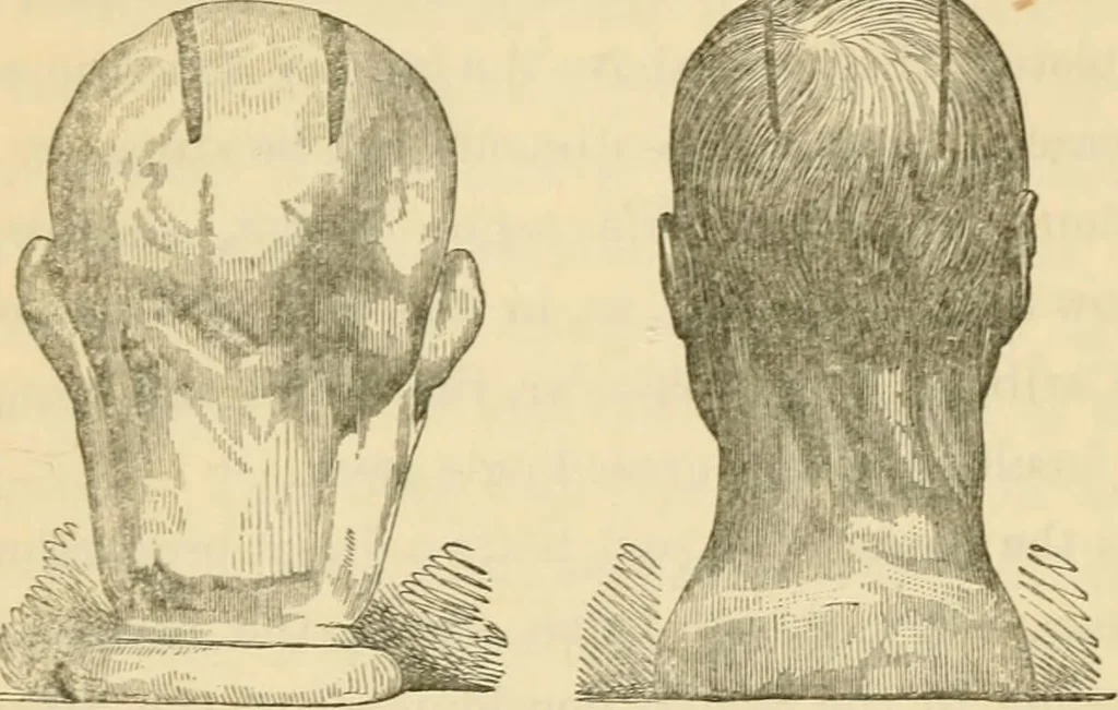 An illustration from The fundamental principles of phrenology are the only principles capable of being reconciled with the immateriality and immortality of the soul, 1868, leaf 483