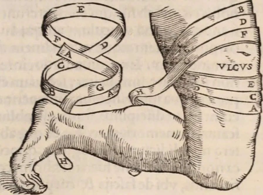 An illustration from Galeni omnia quae extant opera : in latinum sermonem conuersa, 1565, leaf 1020