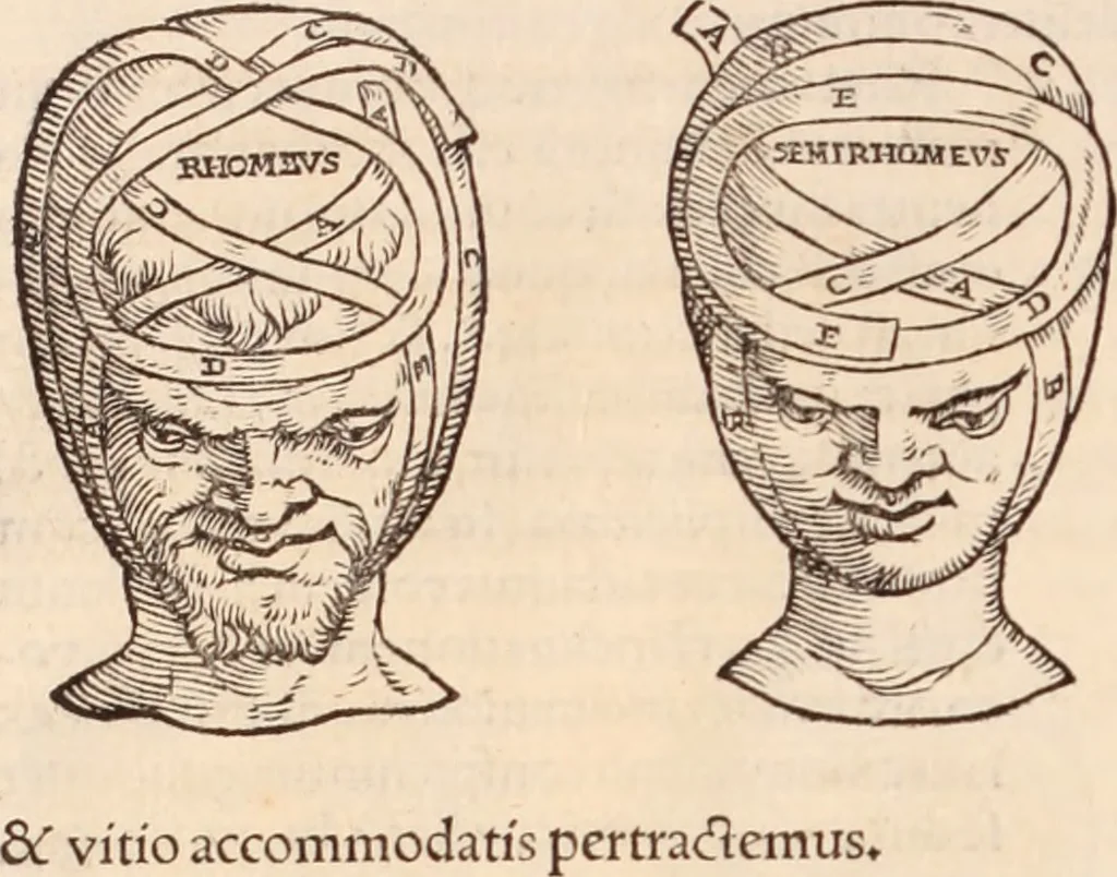 An illustration from Galeni omnia quae extant opera : in latinum sermonem conuersa, 1565, leaf 1021