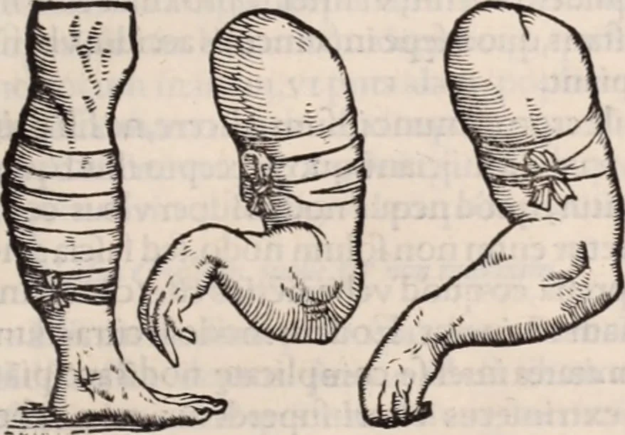 An illustration from Galeni omnia quae extant opera : in latinum sermonem conuersa, 1565, leaf 1022