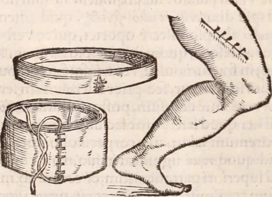 An illustration from Galeni omnia quae extant opera : in latinum sermonem conuersa, 1565, leaf 1023