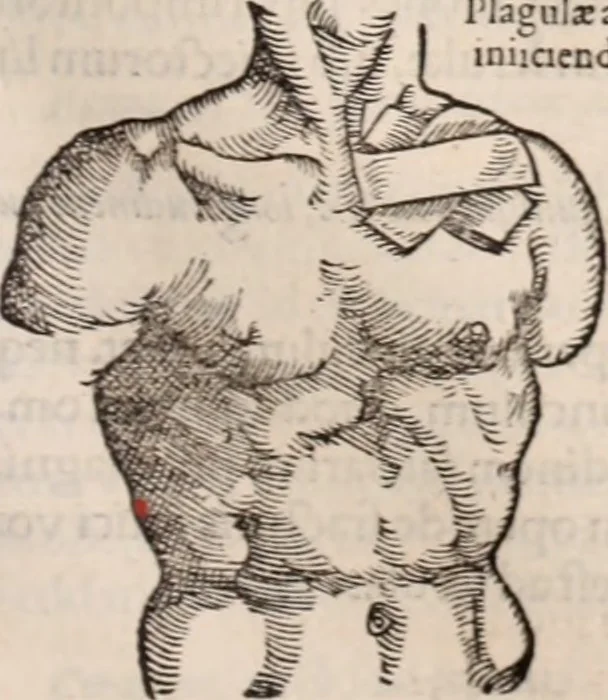 An illustration from Galeni omnia quae extant opera : in latinum sermonem conuersa, 1565, leaf 1036