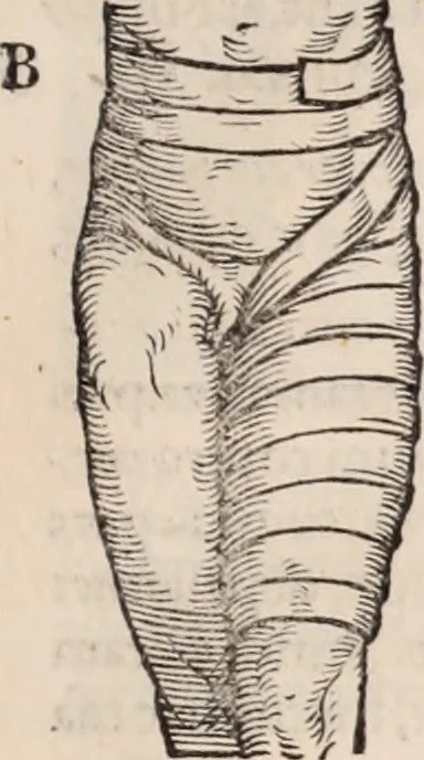 An illustration from Galeni omnia quae extant opera : in latinum sermonem conuersa, 1565, leaf 1090