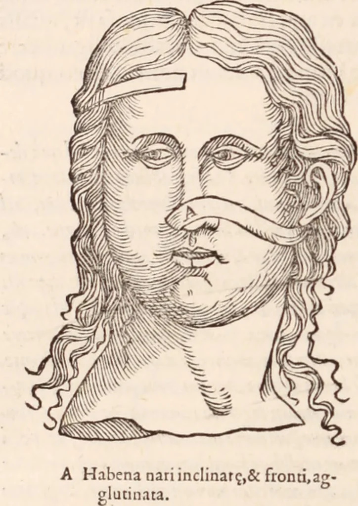 An illustration from Galeni omnia quae extant opera : in latinum sermonem conuersa, 1565, leaf 1143