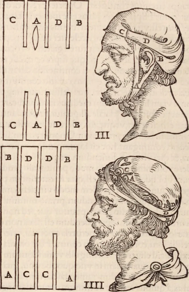 An illustration from Galeni omnia quae extant opera : in latinum sermonem conuersa, 1565, leaf 1197